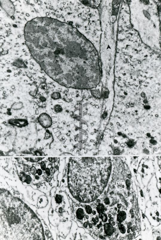 Sezioni ultrasottili di cellule con nucleo ben preservato e citoplasma molto estratto