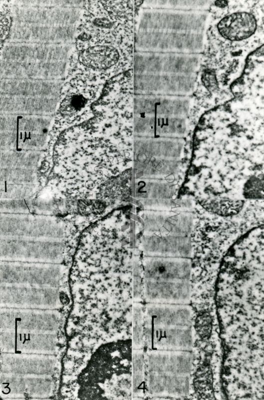 Quattro particolari diversi di fibrocellule. A destra sono visibili porzioni dei nuclei mentre a sinistra sono visibili le miofibrille con la caratteristica struttura a bande