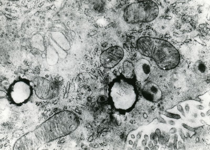 Porzione di un citoplasma di una cellula in cui sono visibili diversi organuli quali mitocondri e vescicole