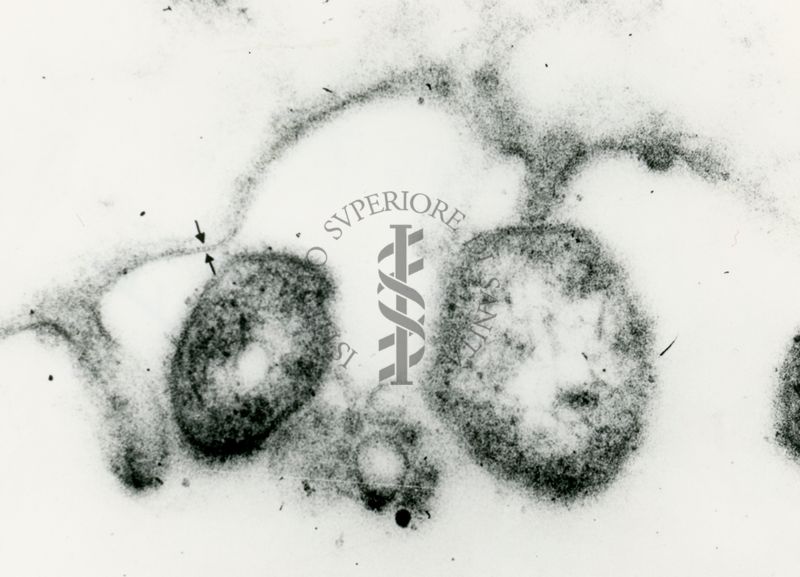 Micrografia elettronica che mostra i punti di contatto tra le pareti di cellule microbiche e la membrana plastica della cellula ospite