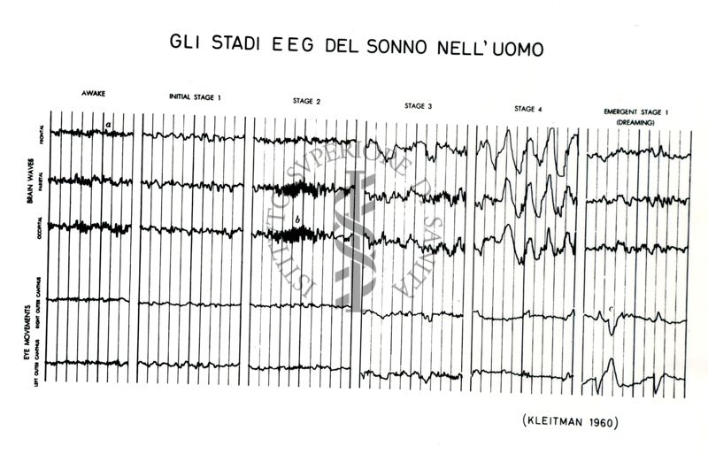 Senza titolo