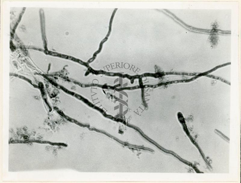 Micelio in Penicillium in coltura sommersa - 650 inrg.(8)