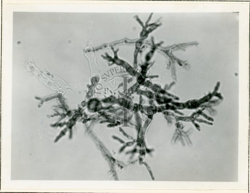 Micelio in Penicillium in coltura sommersa - 650 inrg.(2)