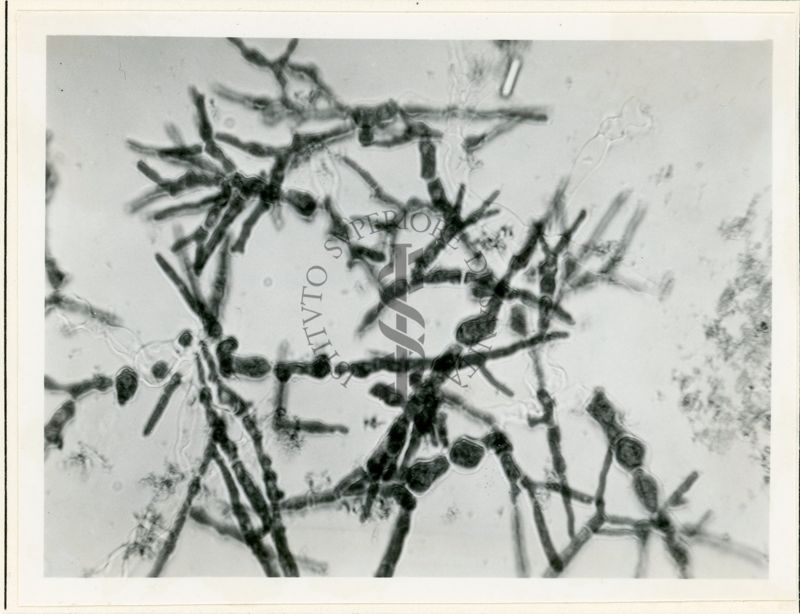 Micelio in Penicillium in coltura sommersa - 650 inrg.(4)