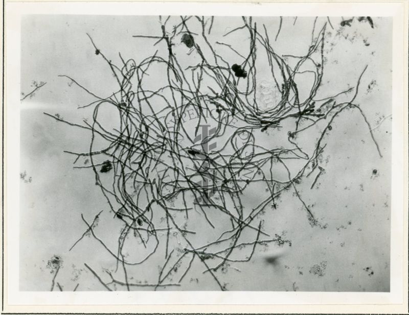 Micelio in Penicillium in coltura sommersa - 150 inrg.(4)