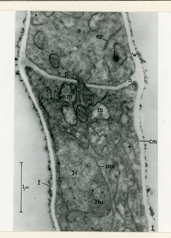 Fotografia elettronica di Neurospora