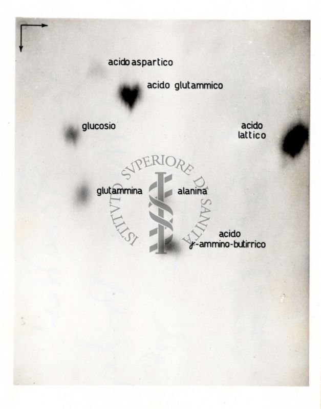 Metabolismo del glucosio nel cervello di ratto