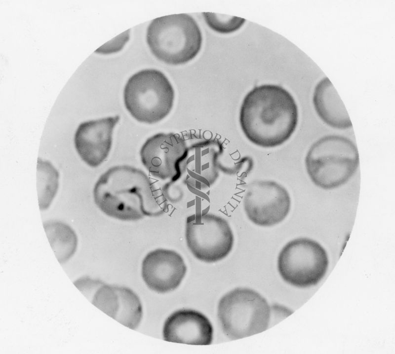 Spirochete della febbre ricorrente (particolare tipo di batteri a forma di spirale)