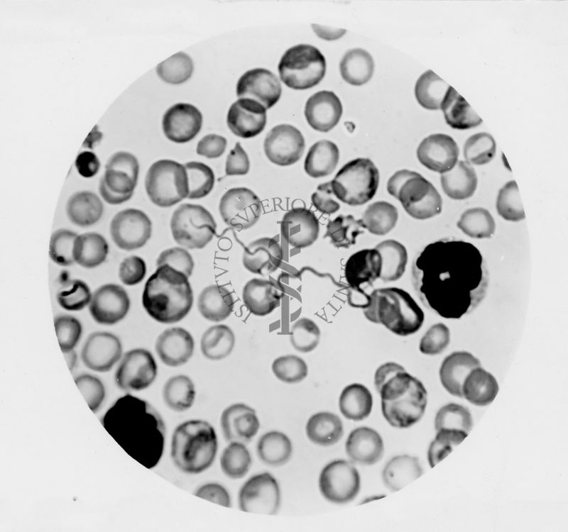 Spirochete della febbre ricorrente (particolare tipo di batteri a forma di spirale)