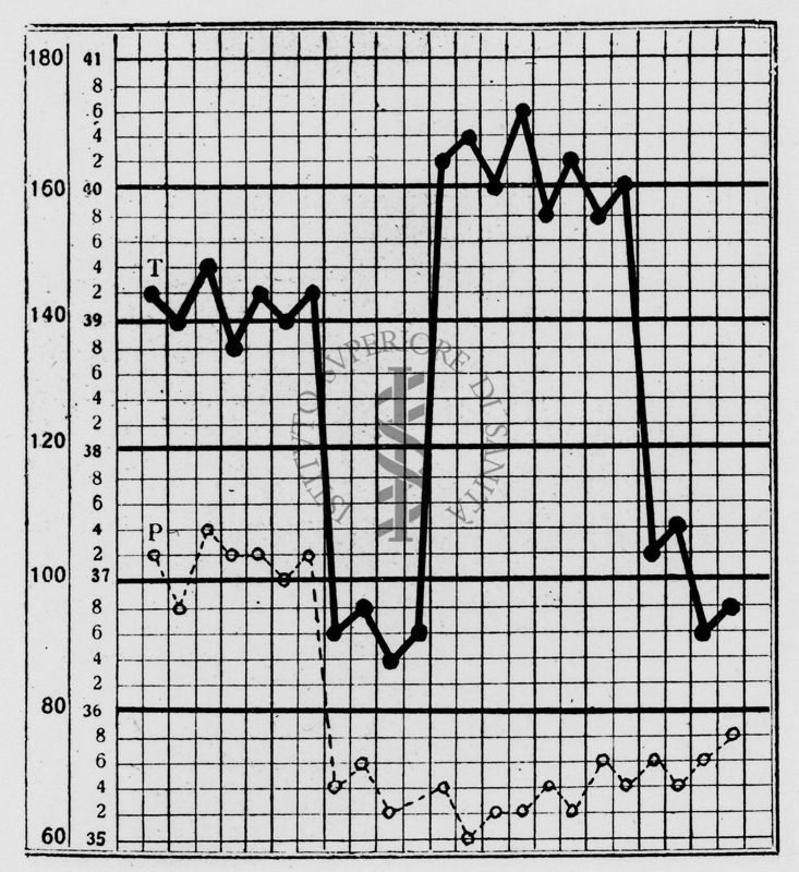 Meningo-tifo eruttivo con curva febbrile di tipo comune