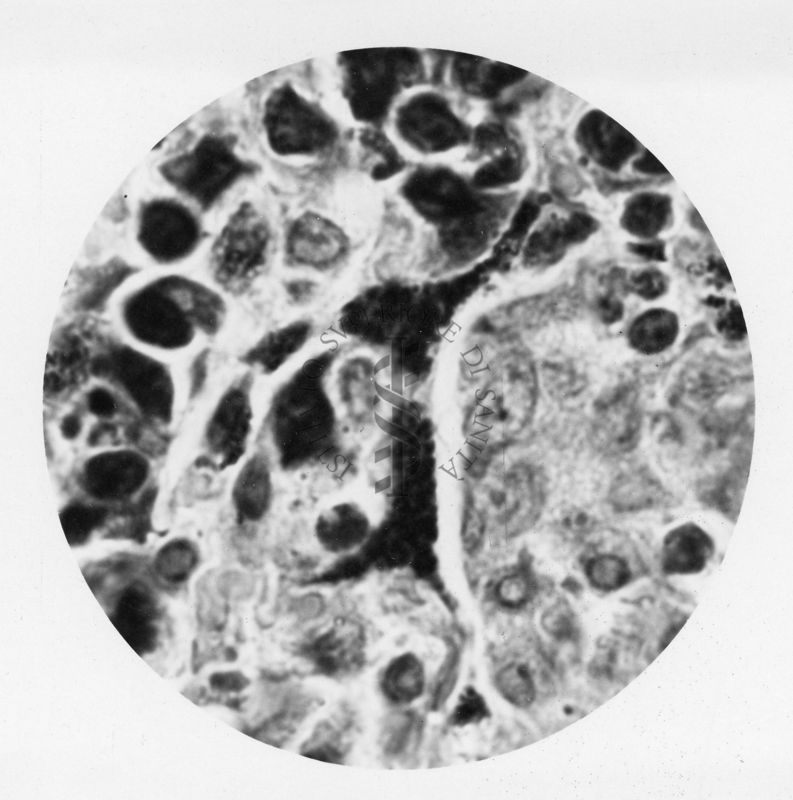 Cellule del polmone di coniglio contenenti Rickettsia