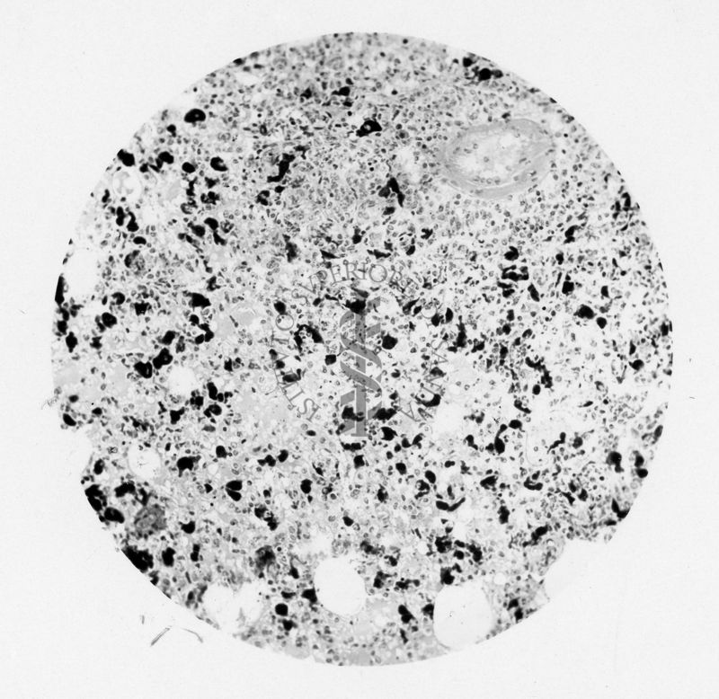 Cellule del polmone di topolino contenente Rickettsia