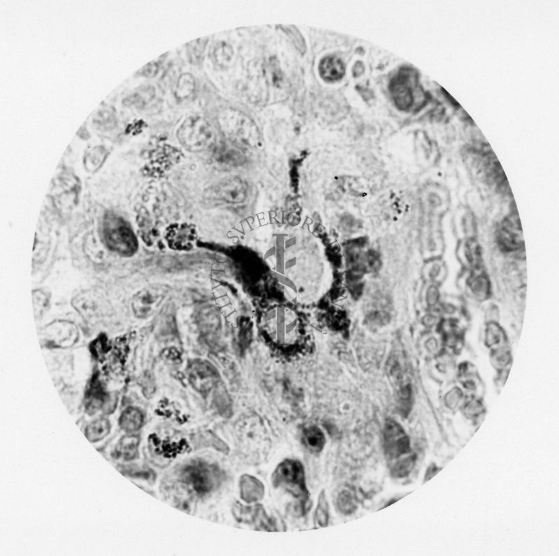 Cellule di polmone di coniglio contenenti Rickettsia