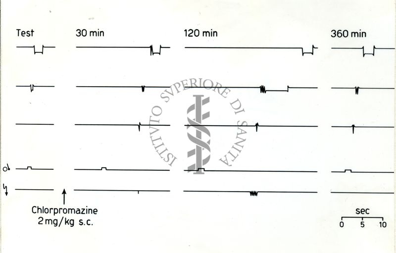 Tracciati sotto i quali è scritto: Chlorpromazine