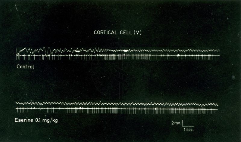 Tracciato elettico su cellule corticali trattate con eserina