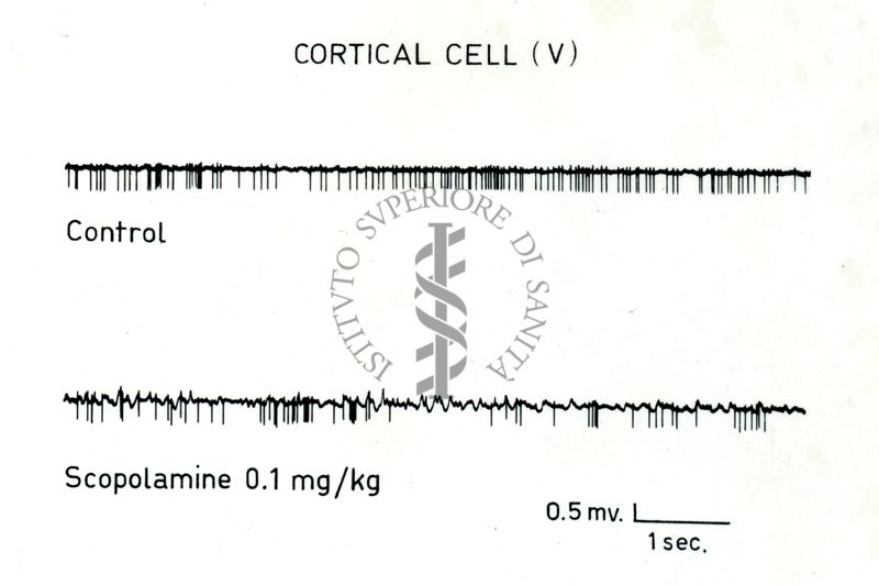 Tracciato elettico su cellule corticali trattate con scopolamina