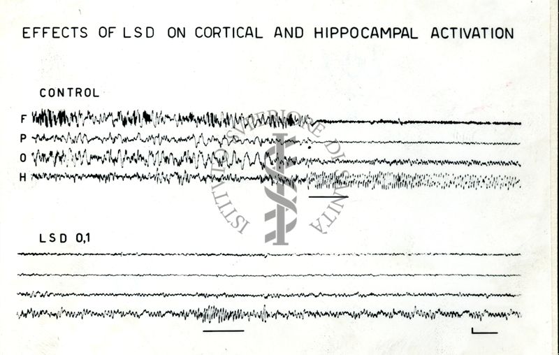 Tracciati EEG: effetti dell'LSD sull'attivazione corticale ed ippocampale