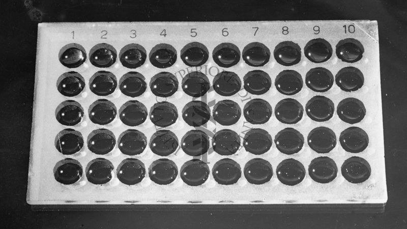 Tecnica per l'agglutinazione di Rickettsia