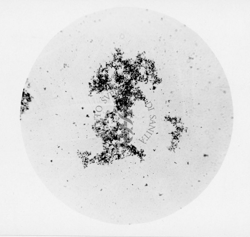 agglutinazione di Rickettsia