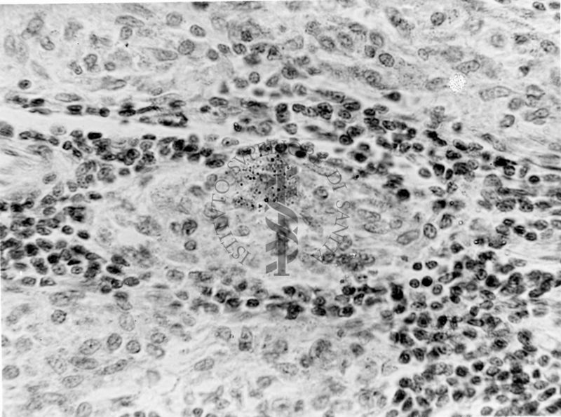 Myicobacterium ceppo Chauviré