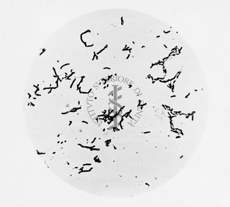 Mycobacterium sp. ceppo Chauviré