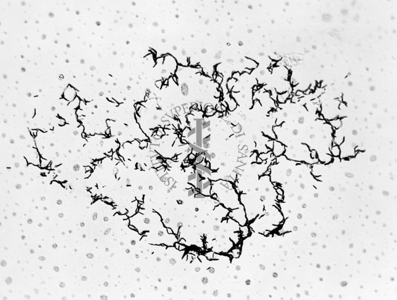 Mycobacterium sp. ceppo Chauviré