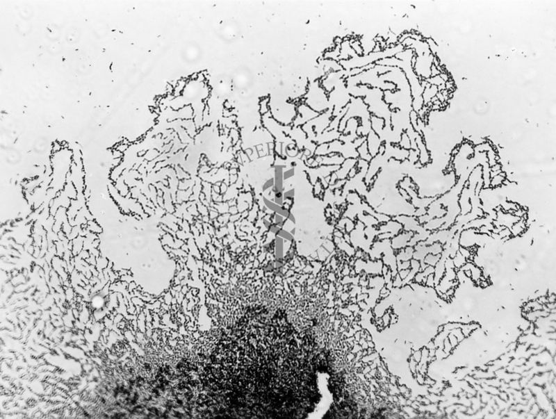 Mycobacterium sp. ceppo Chauviré