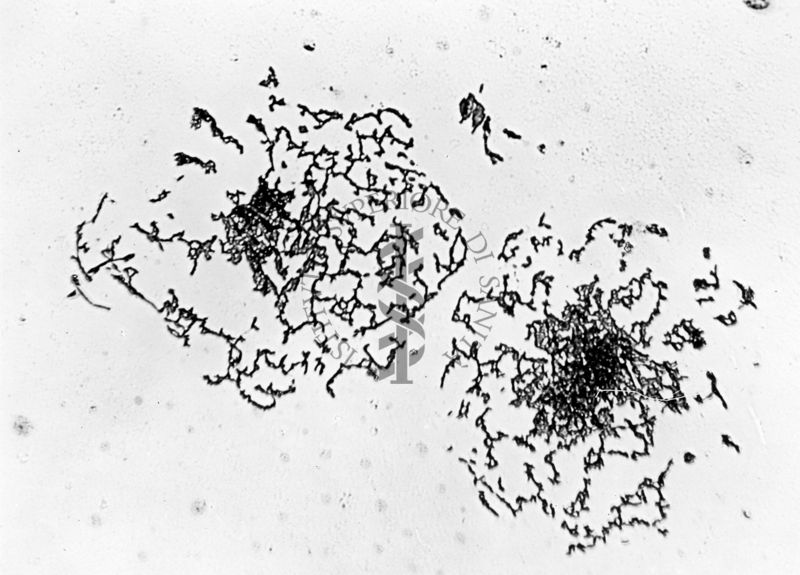 Mycobacterium sp. ceppo Chauviré