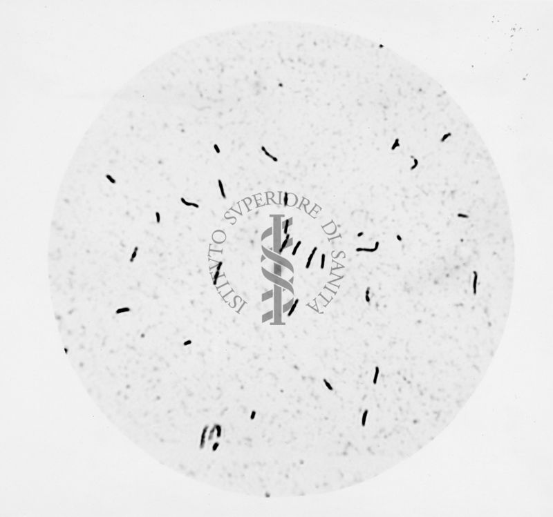 Mycobacterium sp. ceppo Chauviré