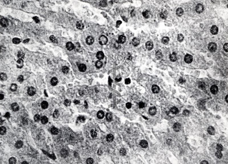 Provocazione sperimentale della flogosi iperergica produttivo-sclerotica (fegato)