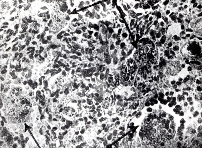 Provocazione sperimentale della flogosi iperergica produttivo-sclerotica (fegato)