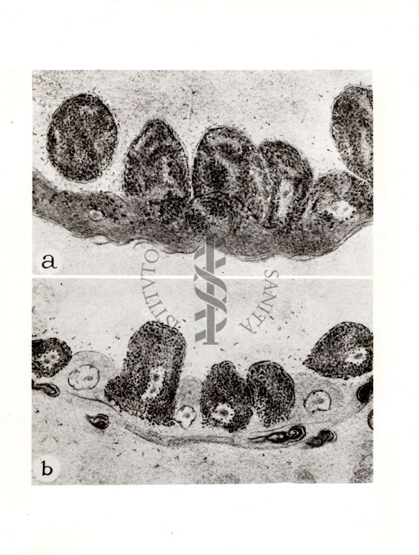 Rickettsia prowazeki nel pidocchio e nel polmone di topo