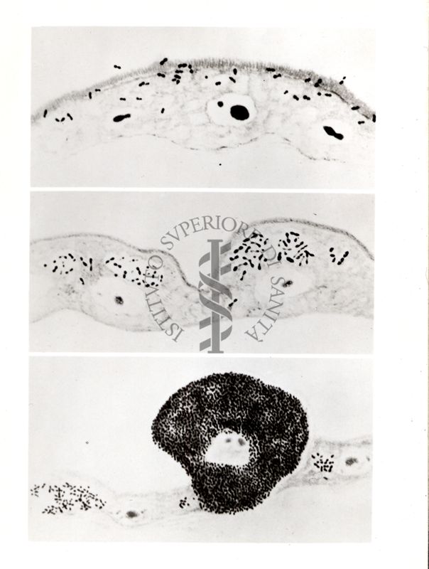 Rickettsia prowazeki del pidocchio (varie e successive dell'infezione)