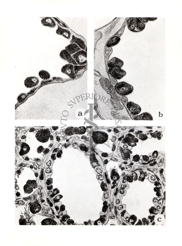 Sezione schematica polmone topo e intestino pidocchio con Rickettsia prowazeki