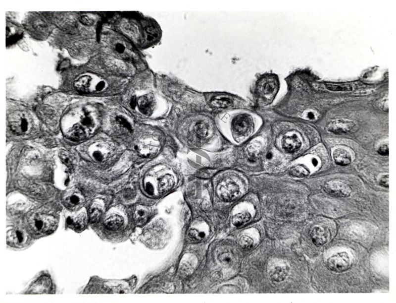 cornea di coniglio nel vaiolo