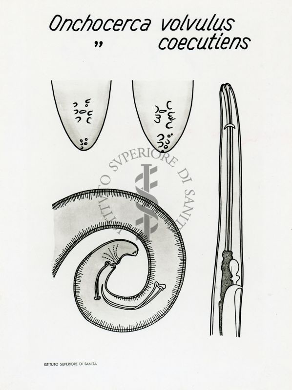 Tav. 38 - Onchocerca Volvulus - Onchocerca Coecutiens