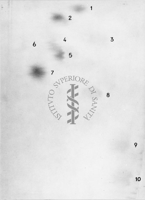 Cromatografia di amminoacidi da urine trattate nel 2014