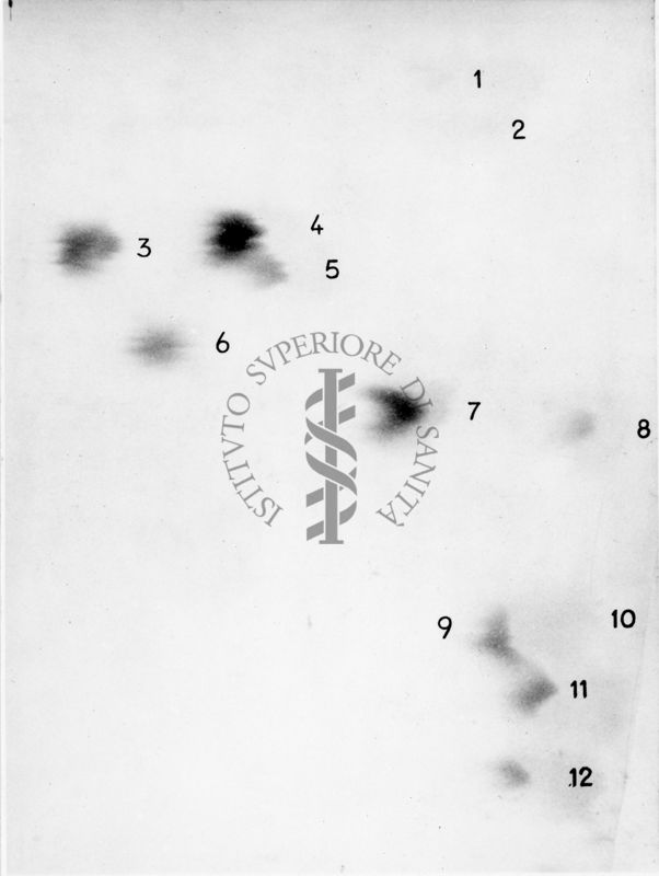 Cromatografia di amminoacidi da urine trattate nel 2014