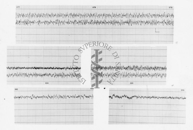 Tracciati elettroencefalografici di coniglio