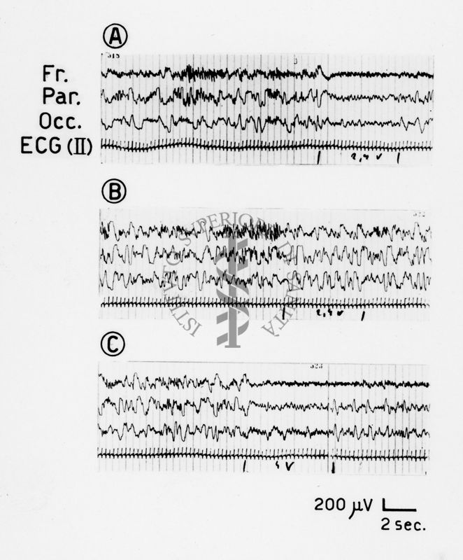 Tracciati elettroencefalografici di coniglio