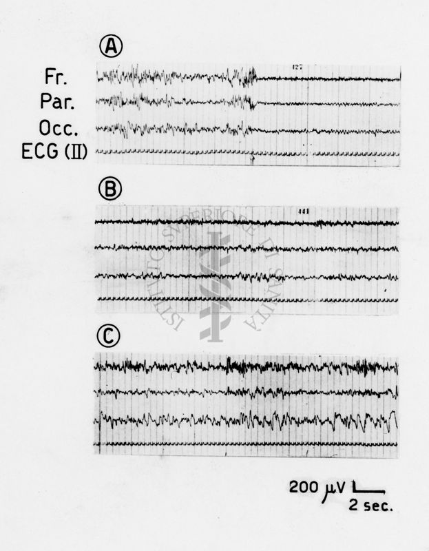 Tracciati elettroencefalografici di coniglio