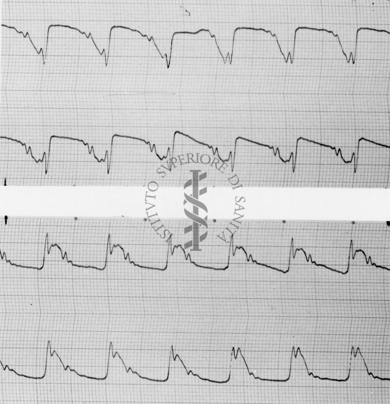 Sfigmogrammi della carotidee dell'aorta del cane