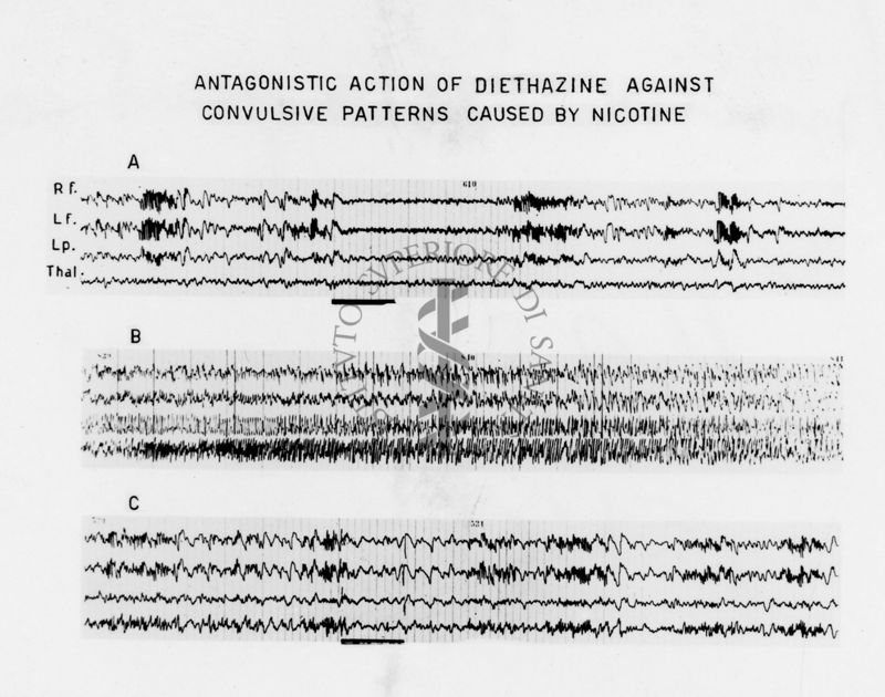 Azione della diotazina sull'elettroencefalogramma