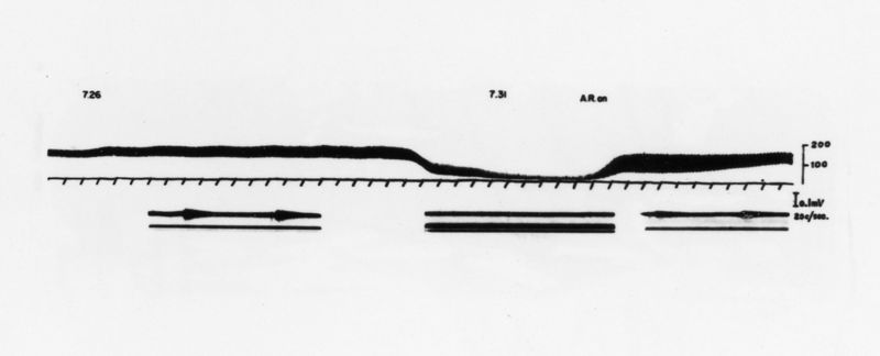 Neurogrammi del frenico