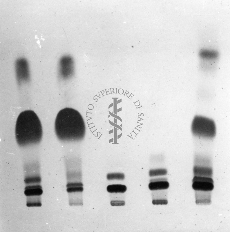 Gel riguardante studi su gas cromatografici