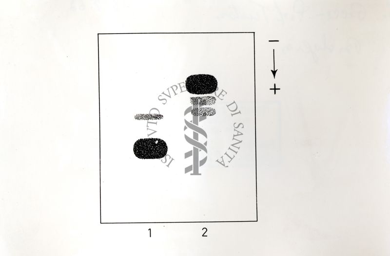 Tracce elettroforetiche