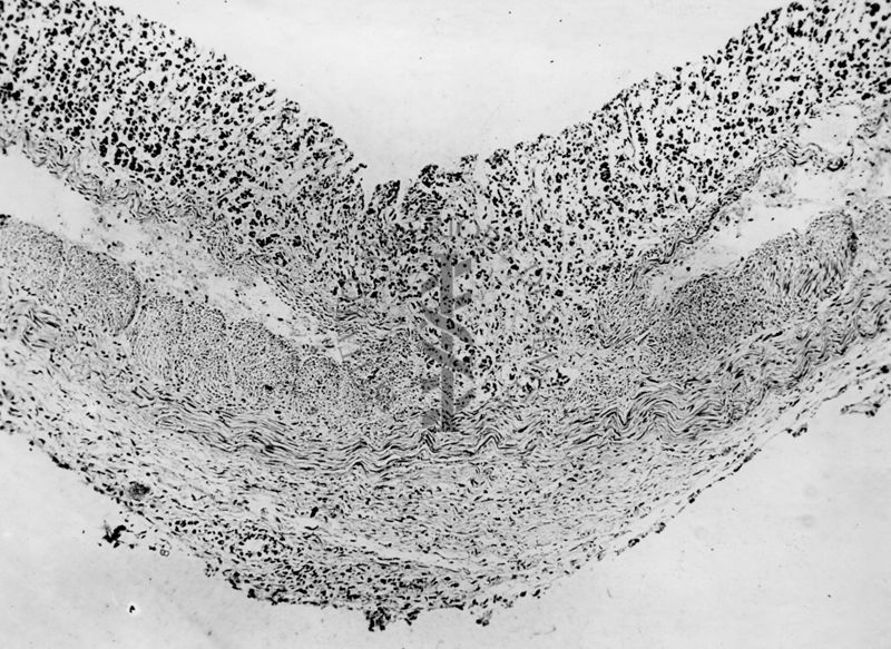 Ulcera sperimentale da istamina nella cavia (fotografie in serie) - micro fotografia originale 60 ingr.