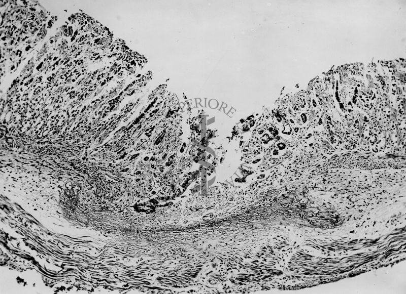 Ulcera sperimentale da istamina nella cavia (fotografie in serie) - micro fotografia originale 60 ingr.