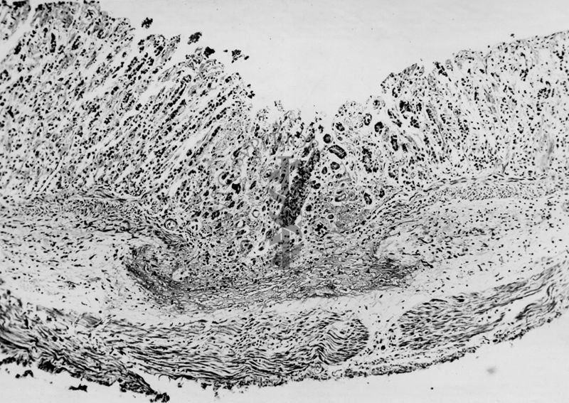 Ulcera sperimentale da istamina nella cavia (fotografie in serie) - micro fotografia originale 200 ingr.