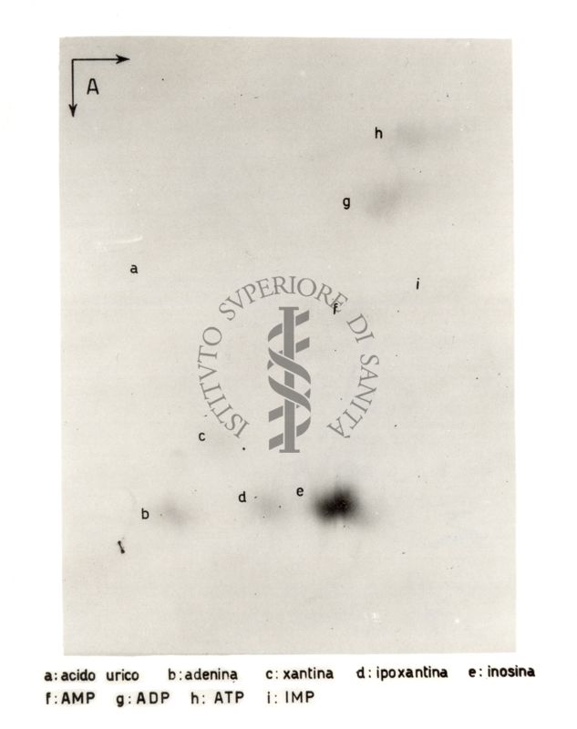 Studio relativo a sostanze trattate con solventi (in esito ad analisi cromatografiche) - a: acido urico; b: adenina; c: xantina; d: ipoxantina; e: inosina; f: AMP; g: ADP; h: ATP; i: IMP